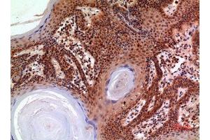 Immunohistochemistry (IHC) analysis of paraffin-embedded Human Skin, antibody was diluted at 1:100. (alpha 2 Macroglobulin anticorps  (Internal Region))