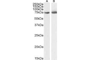 (ABIN185551) (2 μg/mL) staining of HEK293 (A),and A431 (B) nuclear cell lysate (35 μg protein in RIPA buffer). (OGFR anticorps  (C-Term))