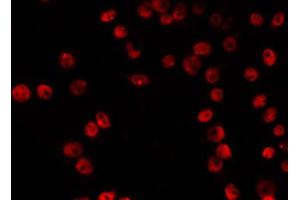ABIN6266828 staining RAW264. (VPS72 anticorps  (Internal Region))