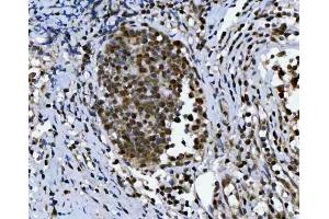 IHC analysis of TRIR using anti-TRIR antibody (ABIN7603244). (Uncharacterized Protein C19orf43 (TRIR) (N-Term) anticorps)