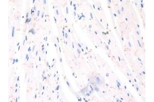 Detection of NCAD in Mouse Heart Tissue using Polyclonal Antibody to N-cadherin (NCAD)