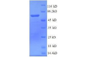 Tubulin, Beta, 3 (TUBB3) (AA 1-210), (partial) protein (GST tag)