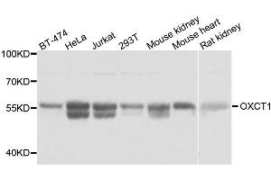 Western blot analysis of extracts of various cell lines, using OXCT1 antibody. (OXCT1 anticorps  (AA 261-520))