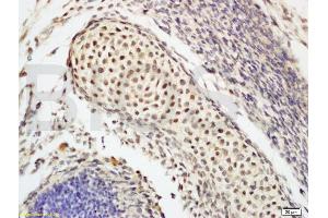Formalin-fixed and paraffin embedded mouse tooth germ labeled with Anti-Oct-3/Oct-4 Polyclonal Antibody, Unconjugated (ABIN737826) at 1:200 followed by conjugation to the secondary antibody and DAB staining. (OCT4 anticorps  (AA 201-300))