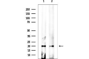 anti-Calpain, Small Subunit 2 (CAPNS2) (Internal Region) antibody