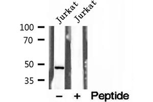 Western blot analysis of extracts of Jurkat cells, using Annexin VII antibody. (Annexin VII anticorps  (N-Term))