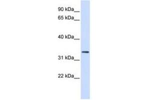 Image no. 1 for anti-F-Box Protein 25 (FBXO25) (AA 36-85) antibody (ABIN6740798) (FBXO25 anticorps  (AA 36-85))