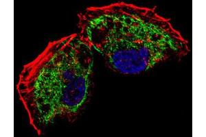 Immunofluorescence (IF) image for anti-Transcription Factor A, Mitochondrial (TFAM) antibody (ABIN5015230) (TFAM anticorps)