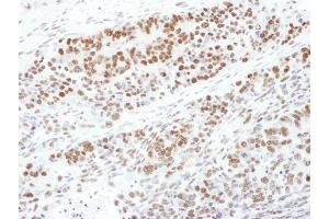 Immunohistochemistry (IHC) image for anti-Mitogen-Activated Protein Kinase Kinase 1 (MAP2K1) (pThr286) antibody (ABIN7454494)