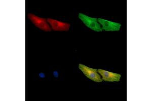 ABIN7096922 and ABIN7100988 staining  cells by IF/ICC.