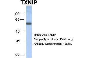 Host: Rabbit Target Name: TXNIP Sample Type: Human Fetal Lung Antibody Dilution: 1. (TXNIP anticorps  (C-Term))