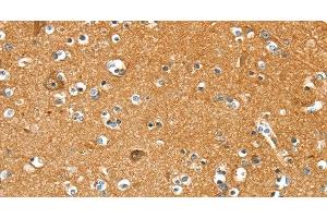 Immunohistochemistry of paraffin-embedded Human brain using PYGL Polyclonal Antibody at dilution of 1:35 (PYGL anticorps)