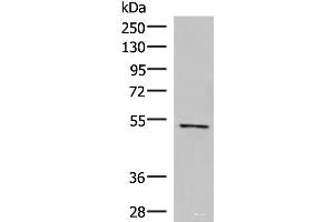 Western blot analysis of Jurkat cell lysate using POLD2 Polyclonal Antibody at dilution of 1:800 (POLD2 anticorps)