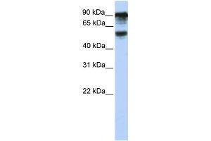 WB Suggested Anti-TBC1D10B Antibody Titration: 0. (TBC1D10B anticorps  (C-Term))