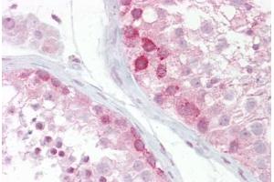 Anti-WNT2B antibody IHC staining of human testis.