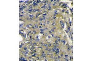 Immunohistochemistry (IHC) image for anti-C-Fos Induced Growth Factor (Vascular Endothelial Growth Factor D) (Figf) antibody (ABIN3002601) (VEGFD anticorps)