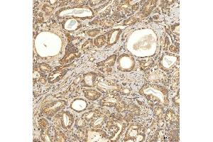 IHC analysis of Citrin/SLC25A13 using anti-Citrin/SLC25A13 antibody (ABIN7599512). (slc25a13 anticorps  (AA 1-643))