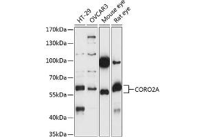 Western blot analysis of extracts of various cell lines, using CORO2A antibody (ABIN7266508) at 1:1000 dilution. (CORO2A anticorps  (AA 376-525))