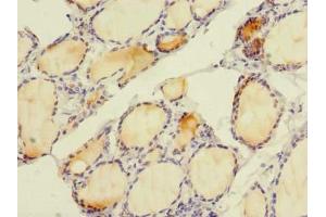 Immunohistochemistry of paraffin-embedded human thyroid tissue using ABIN7151506 at dilution of 1:100