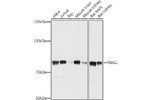 Western blot analysis of extracts of various cell lines, using PI antibody (ABIN6128448, ABIN6145592, ABIN6145594 and ABIN6214191) at 1:1000 dilution. (PIAS1 anticorps  (AA 422-651))