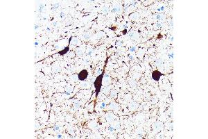 Immunohistochemistry of paraffin-embedded rat brain using Parvalbumin (PVALB) (PVALB) Rabbit mAb (ABIN7269182) at dilution of 1:100 (40x lens).