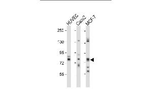 All lanes : Anti-cGKII Antibody (C-term) at 1:1000 dilution Lane 1: HUVEC whole cell lysate Lane 2: Caco2 whole cell lysate Lane 3: MCF-7 whole cell lysate Lysates/proteins at 20 μg per lane.