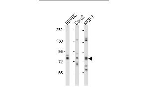All lanes : Anti-cGKII Antibody (C-term) at 1:1000 dilution Lane 1: HUVEC whole cell lysate Lane 2: Caco2 whole cell lysate Lane 3: MCF-7 whole cell lysate Lysates/proteins at 20 μg per lane. (PRKG2 anticorps  (C-Term))