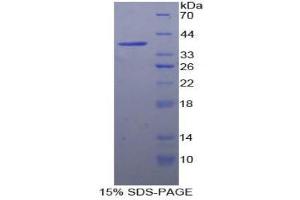 SDS-PAGE (SDS) image for Fatty Acid Synthase (FASN) (AA 26-78) protein (His tag,GST tag) (ABIN2122818)
