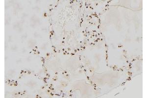 ABIN6264139 and ABIN6277592 at 1/100 staining Human lung tissue by IHC-P.