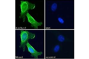 ABIN570923 Immunofluorescence analysis of paraformaldehyde fixed 3T3-L1 cells, permeabilized with 0. (TREM2 anticorps  (Internal Region))