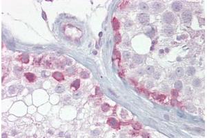 Anti-SYCP1 antibody IHC staining of human testis.