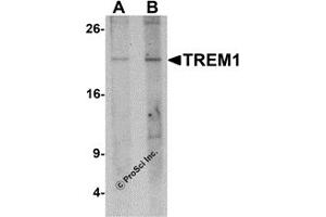 Western Blotting (WB) image for anti-Triggering Receptor Expressed On Myeloid Cells 1 (TREM1) (N-Term) antibody (ABIN1077426) (TREM1 anticorps  (N-Term))