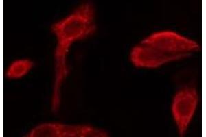 ABIN6279673 staining NIH-3T3 cells by IF/ICC. (PABPC3 anticorps)