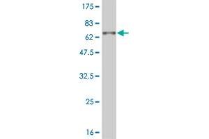 Western Blot detection against Immunogen (57. (DLX3 anticorps  (AA 1-287))