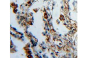 IHC-P analysis of lung tissue, with DAB staining. (FES anticorps  (AA 510-770))