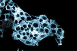 Immunofluorescent staining of HepG2 cells with anti-ALDH.