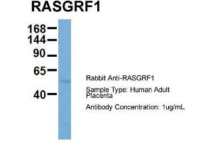 Host: Rabbit  Target Name: RASGRF1  Sample Tissue: Human Adult Placenta  Antibody Dilution: 1. (RASGRF1 anticorps  (Middle Region))