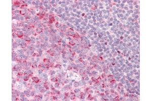 Anti-PELI1 / Pellino 1 antibody IHC staining of human tonsil. (Pellino 1 anticorps  (C-Term))