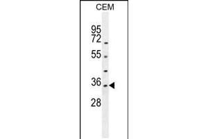 Western blot analysis in CEM cell line lysates (35ug/lane). (LDHAL6A anticorps  (AA 154-183))