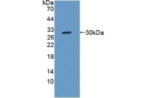 Detection of Recombinant NOTCH2NL, Human using Polyclonal Antibody to Notch2 N-Terminal Like Protein (NOTCH2NL) (NOTCH2NL anticorps  (AA 1-236))