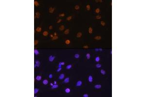 Immunofluorescence analysis of C6 cells using DDIT3/CHOP antibody (ABIN3020709, ABIN3020710, ABIN3020711, ABIN1512759 and ABIN6213685) at dilution of 1:100. (DDIT3 anticorps  (C-Term))