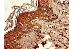 Immunohistochemistry of paraffin-embedded human skin tissue using ABIN7168111 at dilution of 1:100