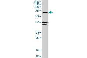 GPT MaxPab rabbit polyclonal antibody.