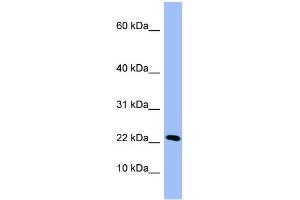 WB Suggested Anti-PIN4  Antibody Titration: 0.