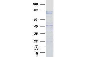 Validation with Western Blot