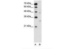 Image no. 2 for anti-Solute Carrier Family 36 (Proton/amino Acid Symporter), Member 3 (SLC36A3) (N-Term) antibody (ABIN205028) (SLC36A3 anticorps  (N-Term))