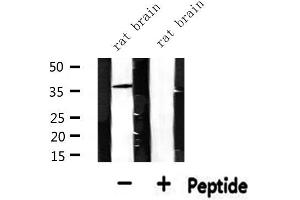 Western blot analysis of extracts from rat brain, using CDKL4 Antibody. (CDKL4 anticorps  (Internal Region))