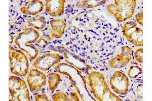 Immunohistochemistry of paraffin-embedded human kidney tissue using ABIN7143334 at dilution of 1:100 (ADCY6 anticorps  (AA 9-118))