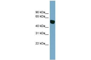 WB Suggested Anti-SLC38A5 Antibody Titration:  0.