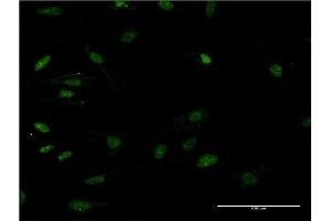 Immunofluorescence of monoclonal antibody to HMGB2 on HeLa cell. (HMGB2 anticorps  (AA 1-195))
